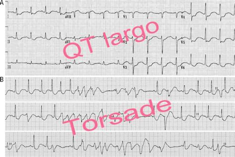 Qt Sinal De Fenda Virtual